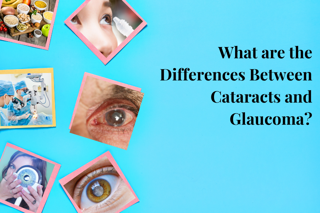 What are the Differences Between Cataracts and Glaucoma