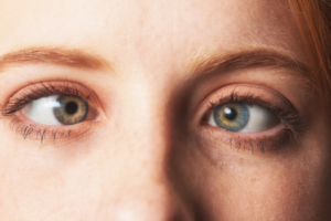 squint eye surgery in Thane