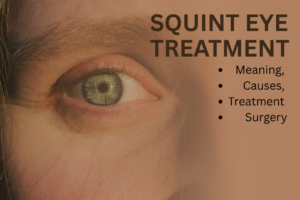 Squint Eye Treatment