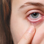 Best Eye doctor for Dry Eyes in Kalyan